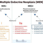 Mnemonic Multiple Endocrine Neoplasia Multiple Endocrine Neoplasia